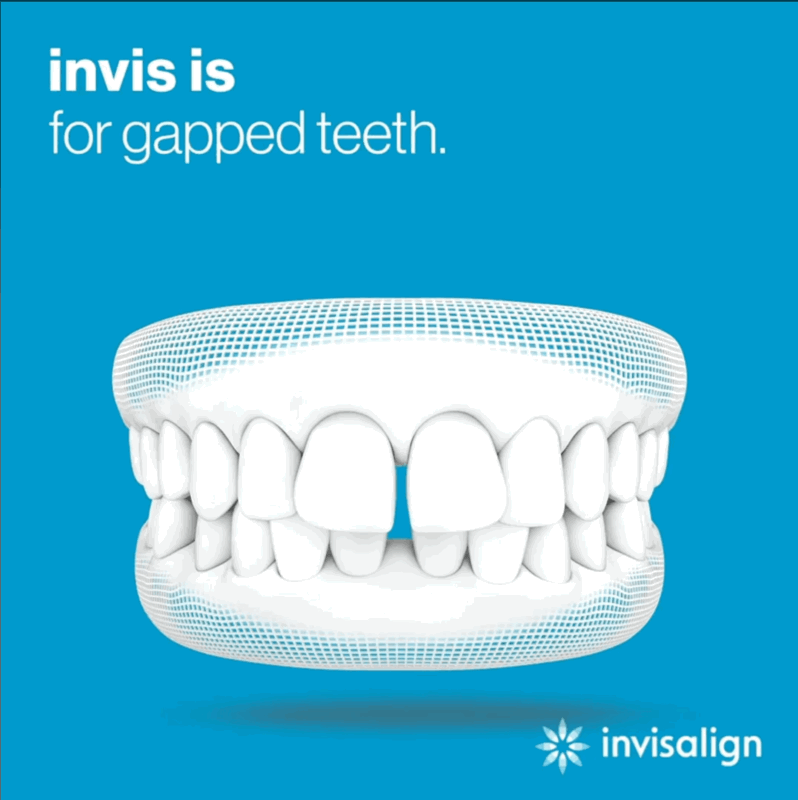 CleanShot 1447-06-17 at 16.25.35